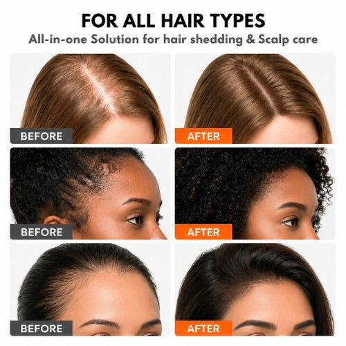 Revée Hair Growth Serum