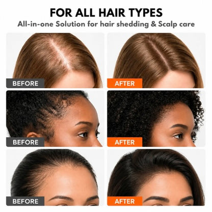 Revée Hair Growth Serum